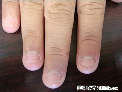 剪指甲、挖耳屎，这些日常小动作竟隐藏大危害！ - 七台河生活资讯 - 七台河28生活网 qth.28life.com